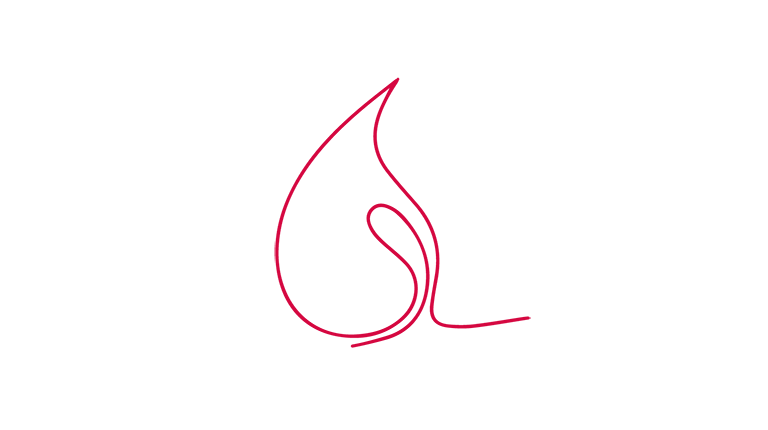 EISENMANGEL