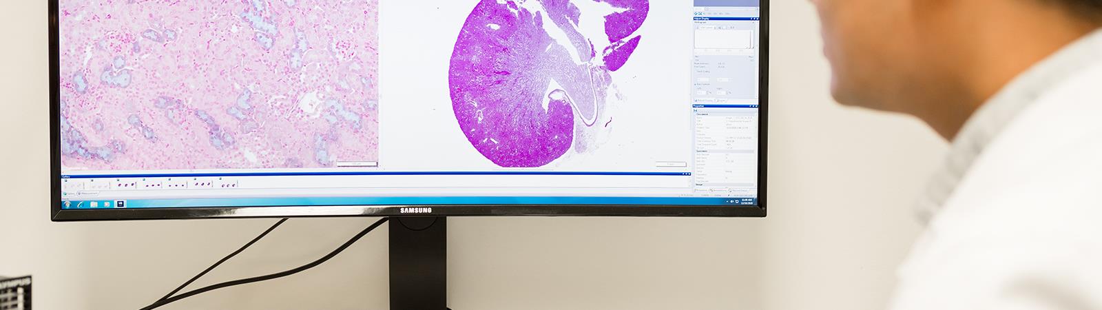 Nephrology Banner